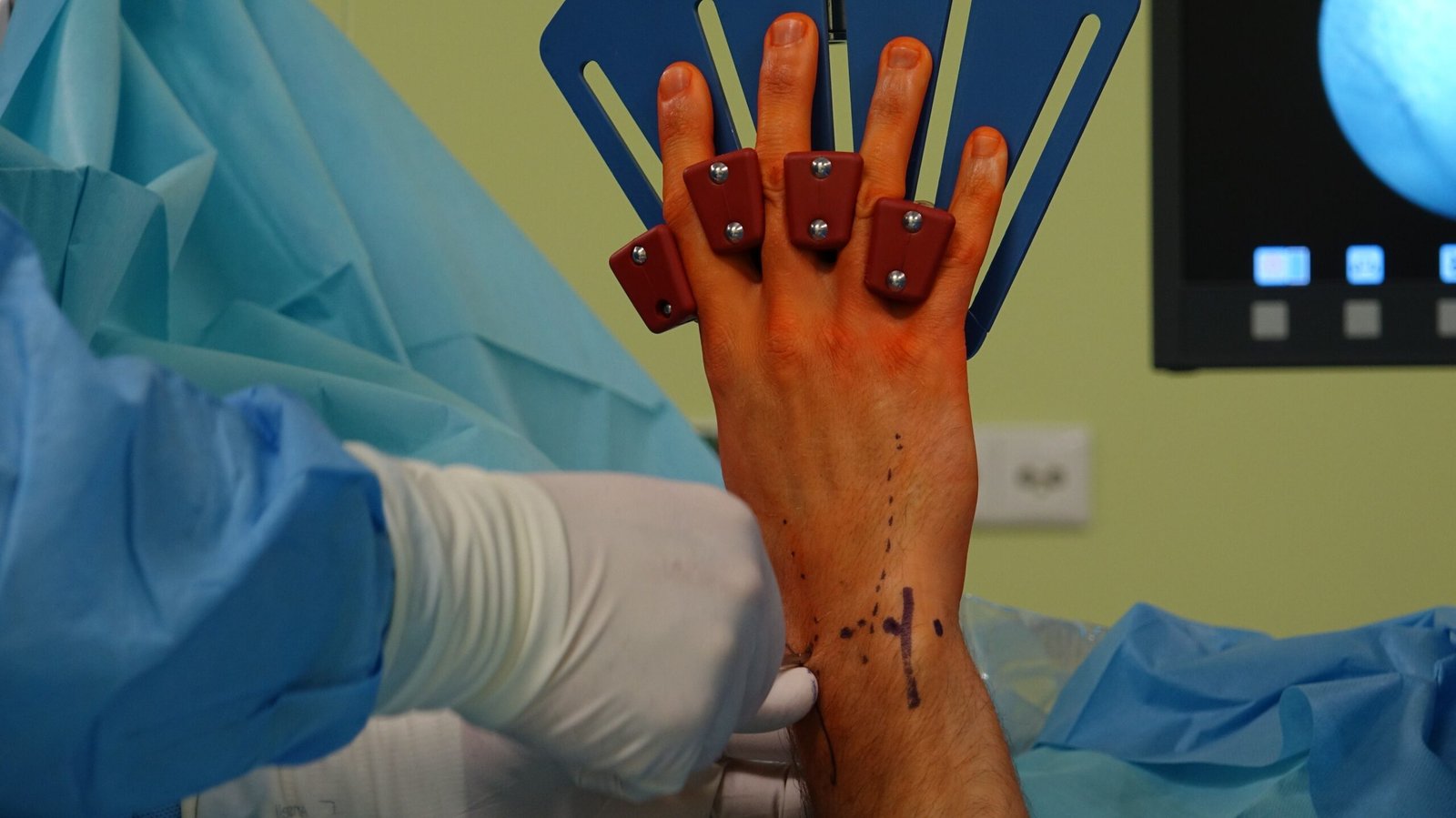 Read more about the article How to Choose the Best Orthopedic Doctor in Guntur